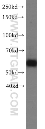 PTPIP51 Antibody in Western Blot (WB)