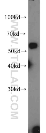 PTPIP51 Antibody in Western Blot (WB)