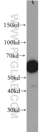 PTPIP51 Antibody in Western Blot (WB)