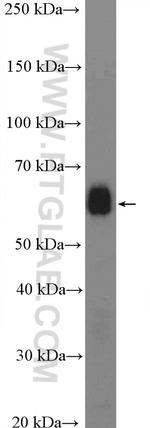 Fibrinogen alpha chain Antibody in Western Blot (WB)