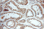 BRCA1 Antibody in Immunohistochemistry (Paraffin) (IHC (P))