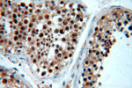 BRCA1 Antibody in Immunohistochemistry (Paraffin) (IHC (P))