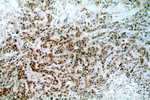 BRCA1 Antibody in Immunohistochemistry (Paraffin) (IHC (P))