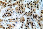 BRCA1 Antibody in Immunohistochemistry (Paraffin) (IHC (P))