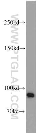 BRCA1 Antibody in Western Blot (WB)