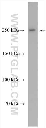 BRCA1 Antibody in Western Blot (WB)