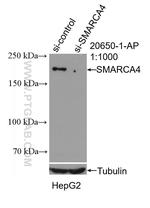 SMARCA4/BRG1 Antibody in Western Blot (WB)
