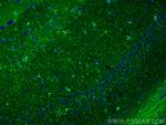 MARCKS Antibody in Immunohistochemistry (PFA fixed) (IHC (PFA))