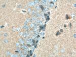 PSD95/DLG4 Antibody in Immunohistochemistry (Paraffin) (IHC (P))