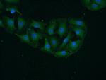 CaMKII alpha Antibody in Immunocytochemistry (ICC/IF)