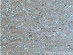 CaMKII alpha Antibody in Immunohistochemistry (Paraffin) (IHC (P))
