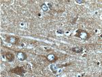 CaMKII alpha Antibody in Immunohistochemistry (Paraffin) (IHC (P))
