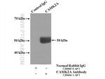 CaMKII alpha Antibody in Immunoprecipitation (IP)