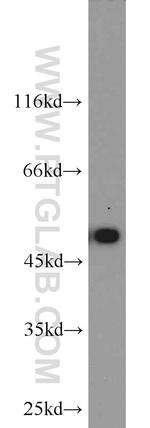 CaMKII alpha Antibody in Western Blot (WB)