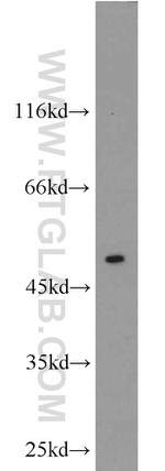 CaMKII alpha Antibody in Western Blot (WB)