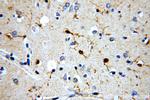 CaMKII delta Antibody in Immunohistochemistry (Paraffin) (IHC (P))
