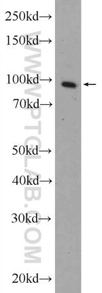 Transportin-1 Antibody in Western Blot (WB)
