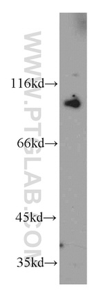 Transportin-1 Antibody in Western Blot (WB)