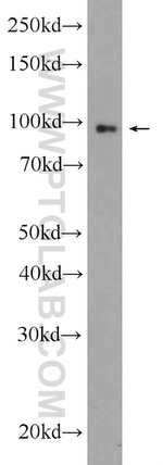 Transportin-1 Antibody in Western Blot (WB)