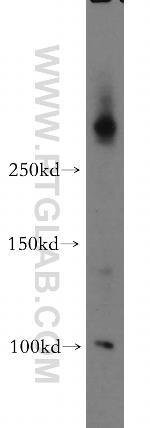 ABCA2 Antibody in Western Blot (WB)