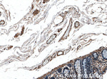FLNB Antibody in Immunohistochemistry (Paraffin) (IHC (P))