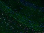 RELN Antibody in Immunohistochemistry (Paraffin) (IHC (P))