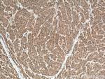 RELN Antibody in Immunohistochemistry (Paraffin) (IHC (P))
