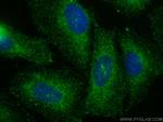 AGRN Antibody in Immunocytochemistry (ICC/IF)