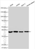 TNFAIP8L3 Antibody in Western Blot (WB)