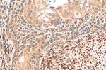 ER Antibody in Immunohistochemistry (Paraffin) (IHC (P))