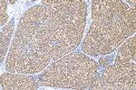 ER Antibody in Immunohistochemistry (Paraffin) (IHC (P))
