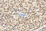 ER Antibody in Immunohistochemistry (Paraffin) (IHC (P))