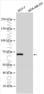 ER Antibody in Western Blot (WB)