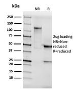AKT1 Antibody in SDS-PAGE (SDS-PAGE)