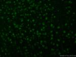 RUNX2 Antibody in Immunohistochemistry (Paraffin) (IHC (P))