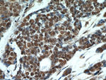 TOP1 Antibody in Immunohistochemistry (Paraffin) (IHC (P))