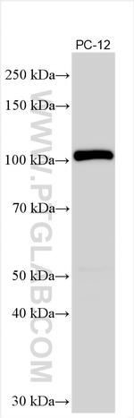 CTNND2 Antibody in Western Blot (WB)
