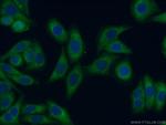 GHR Antibody in Immunocytochemistry (ICC/IF)