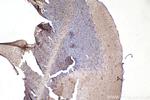 PRKD1 Antibody in Immunohistochemistry (Paraffin) (IHC (P))