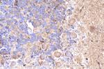 PRKD1 Antibody in Immunohistochemistry (Paraffin) (IHC (P))