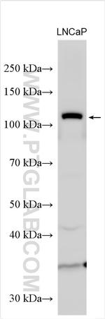 PRKD1 Antibody in Western Blot (WB)