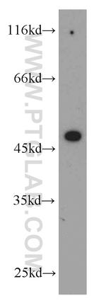 GHRHR Antibody in Western Blot (WB)