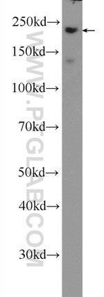 MYH14 Antibody in Western Blot (WB)