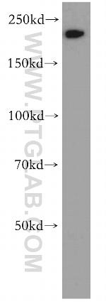 MYH14 Antibody in Western Blot (WB)