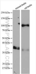 ESPN Antibody in Western Blot (WB)