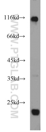ESPN Antibody in Western Blot (WB)