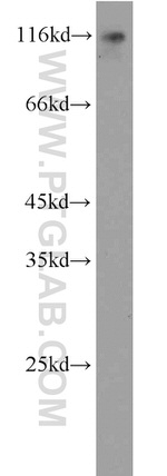 ESPN Antibody in Western Blot (WB)