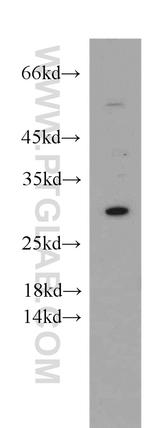 ESPN Antibody in Western Blot (WB)