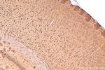 OTOF Antibody in Immunohistochemistry (Paraffin) (IHC (P))