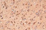 OTOF Antibody in Immunohistochemistry (Paraffin) (IHC (P))